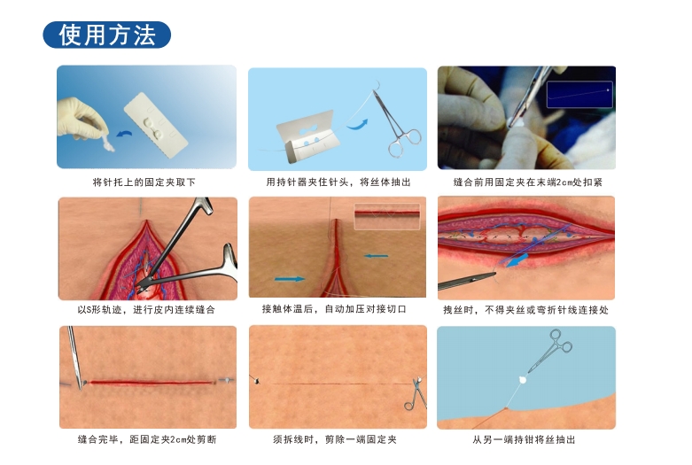 带针钛镍记忆合金缝合线